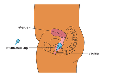 Diagram showing where a menstrual cup is placed